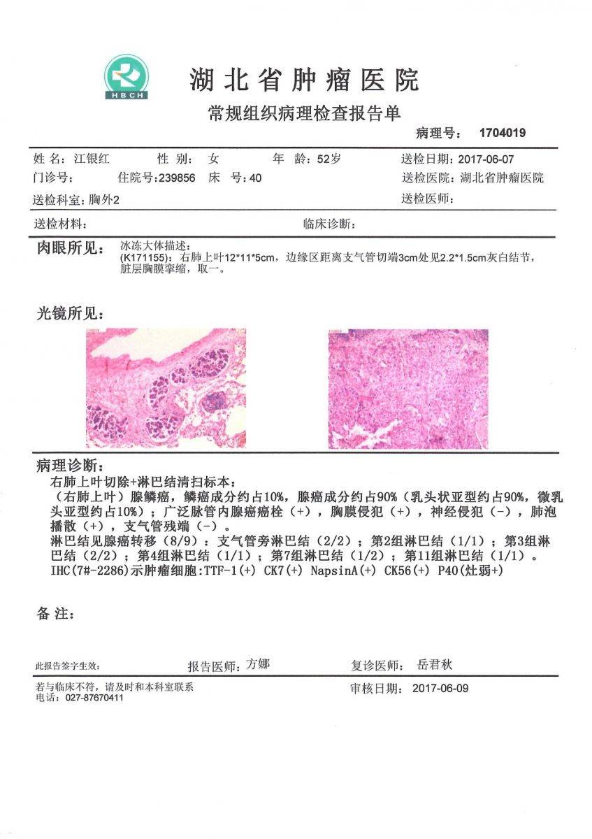 常规组织病理检查报告单_湖北省肿瘤医院